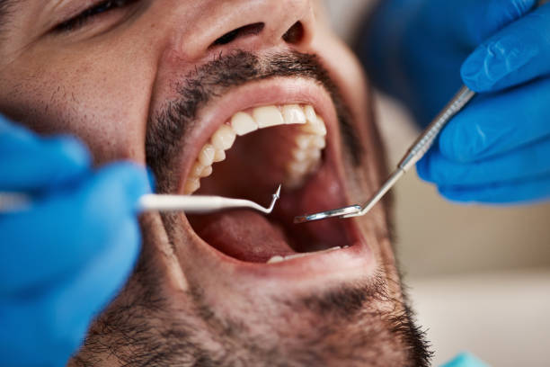 Best Dental Abscess Treatment in Colfax, WI